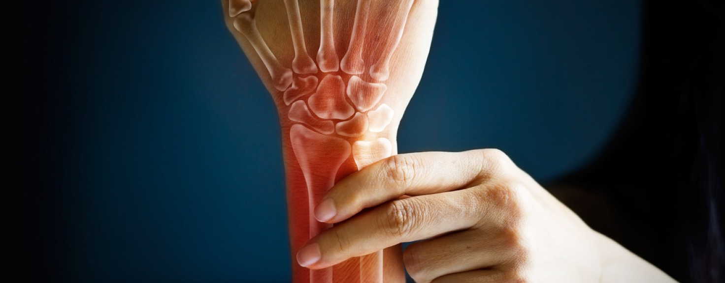 Supplements to improve bone health